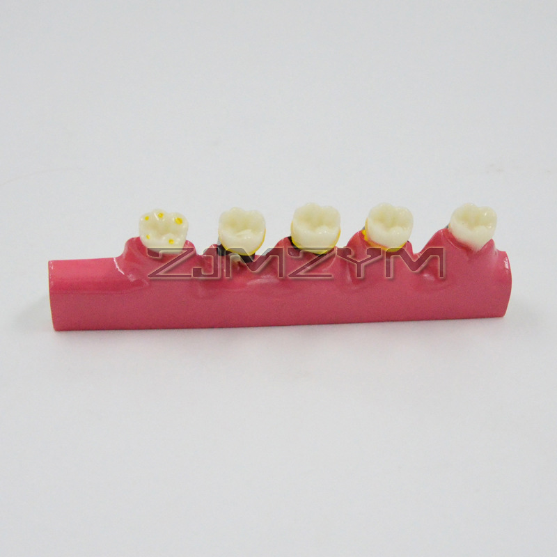 Periodontal Disease Model Dent - огляд і ціна Medical Lab Study