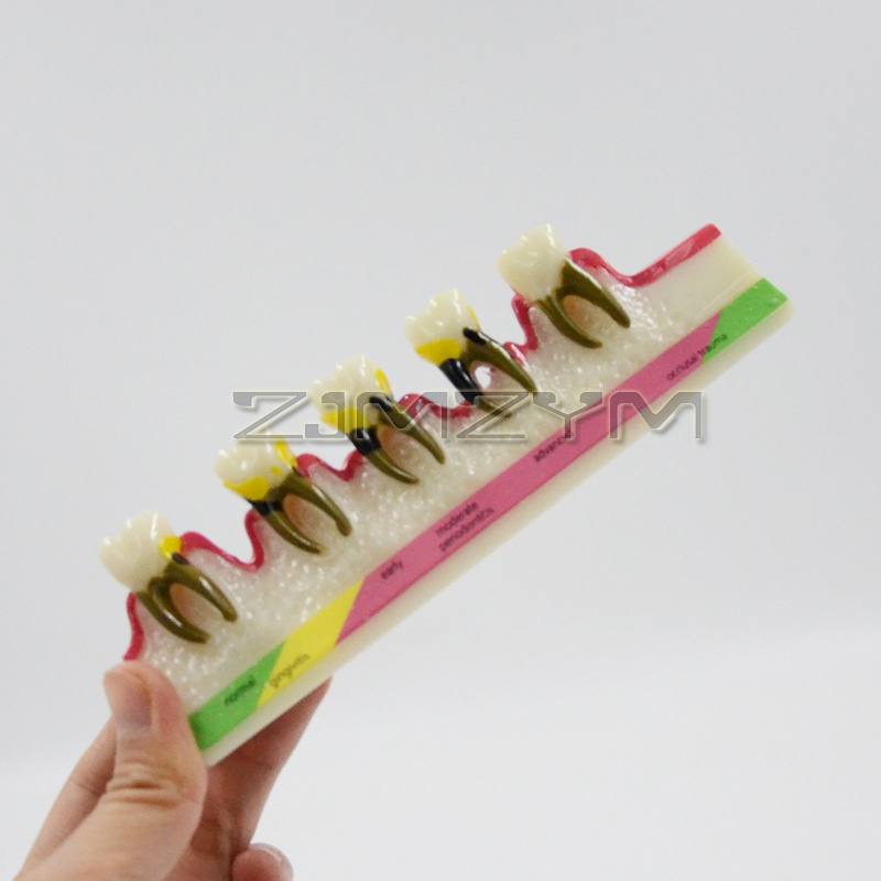 Periodontal Disease Model Dent - огляд і ціна Medical Lab Study