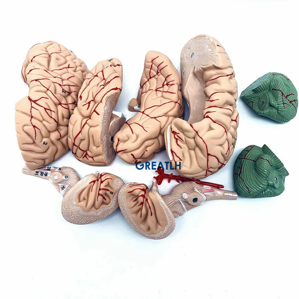 GREATLH Brain Anatomical Model - огляд і ціна Medical Lab Study